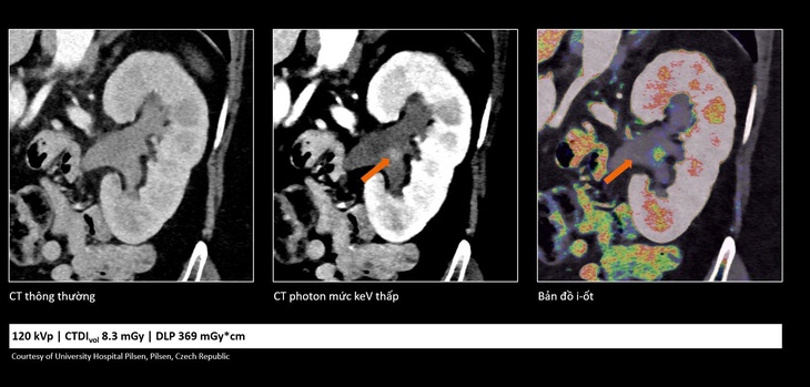Cắt lớp vi tính - Ảnh 3.