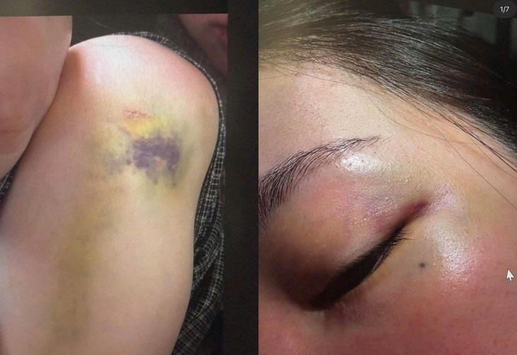 BlackPink - Ảnh 3.