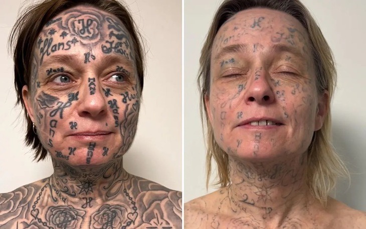 Thử thách 'kẹp chân leo cột đèn' là gì mà phải... né lẹ? - Ảnh 5.