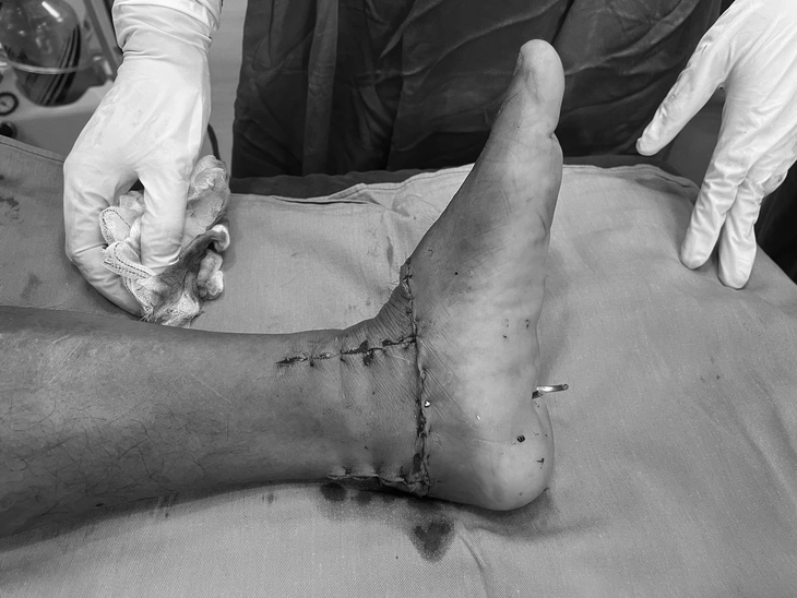 đứt lìa - Ảnh 2.