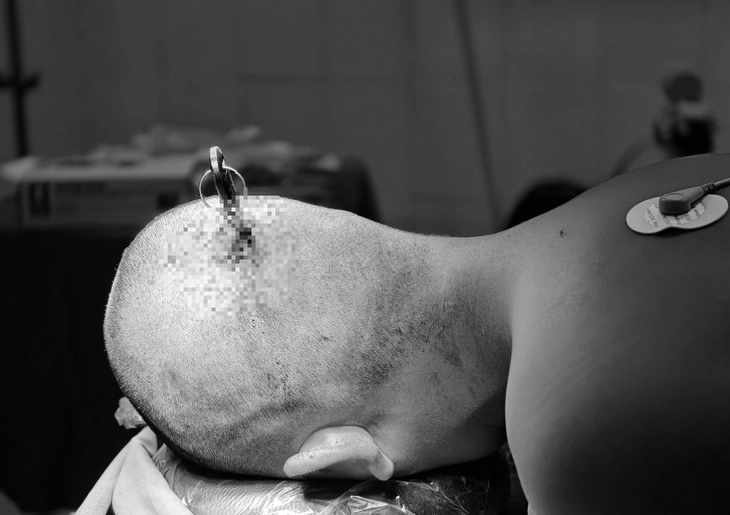 Cảnh báo tai nạn học đường từ những trò đùa nghịch thiếu kiểm soát - Ảnh 2.