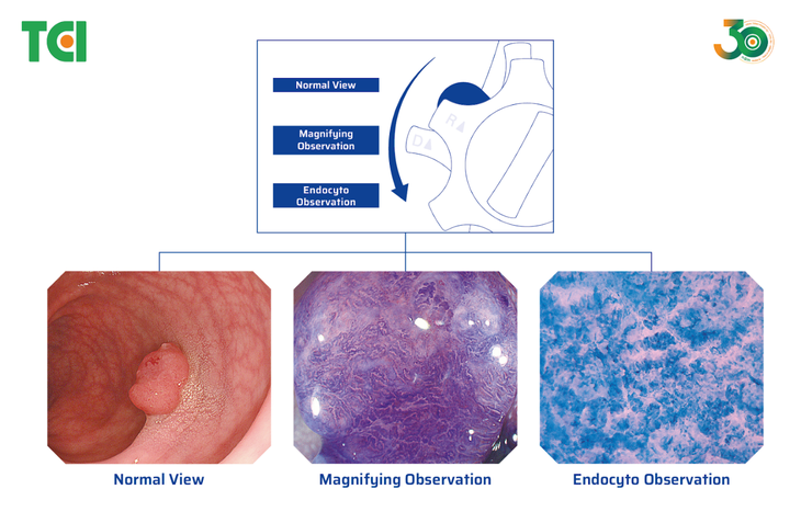 nội soi - Ảnh 2.
