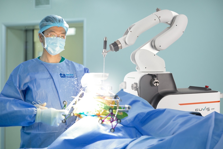 phẫu thuật robot - Ảnh 4.