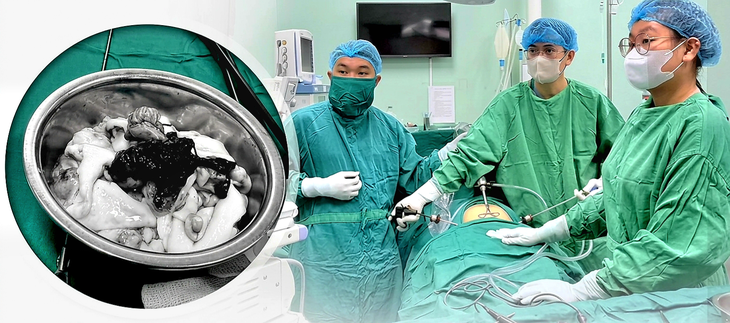 Đừng để đau bụng làm mất khả năng sinh sản - Ảnh 1.