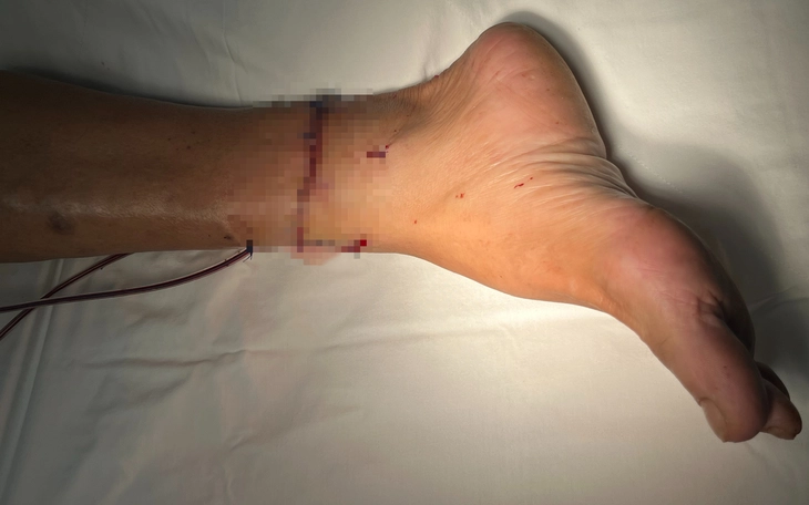Hỗ trợ đưa nạn nhân đứt lìa 4 ngón tay đi cấp cứu - Ảnh 2.