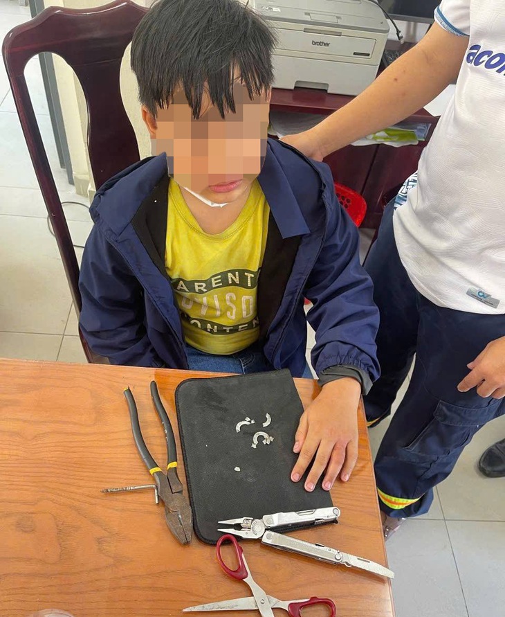 Nghịch đeo nhiều vòng kim loại, học sinh lớp 6 phải nhờ cảnh sát 'giải cứu' - Ảnh 3.