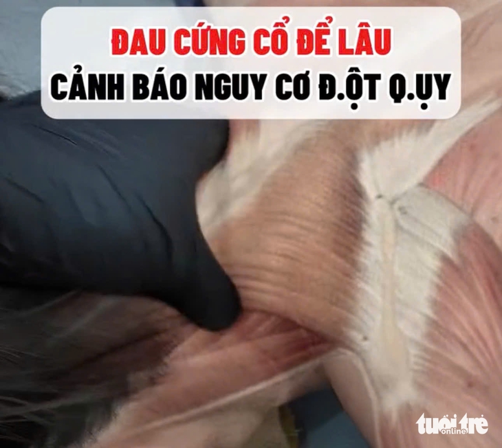 giải cơ - Ảnh 2.