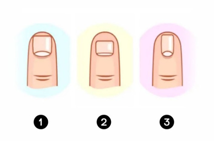 quiz - Ảnh 1.