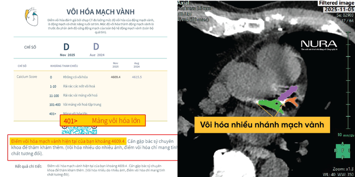AI giúp bác sĩ nhìn thấy nguy cơ tim mạch trước 10 năm - Ảnh 1.