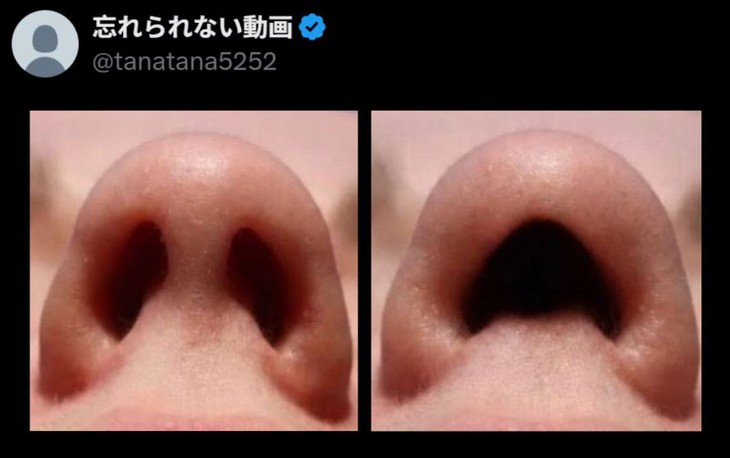 Câu hỏi đang viral: Tại sao con người cần đến 32 chiếc răng? - Ảnh 2.