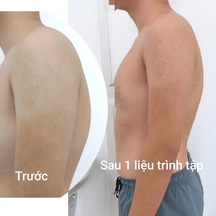 - Ảnh 1.