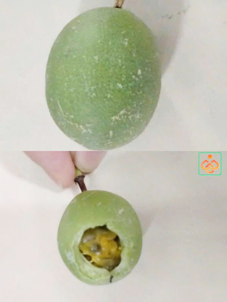 Sau ăn lượng lớn chanh dây rừng còn xanh, 2 trẻ Đà Nẵng nhập viện - Ảnh 2.