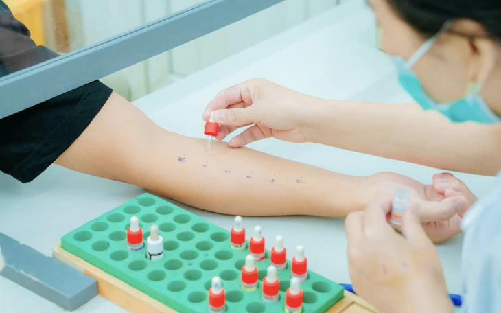 Nghỉ lễ 2-9: Bỏ túi ‘bí kíp’ ngừa dị ứng khi lên rừng, xuống biển - Ảnh 3.