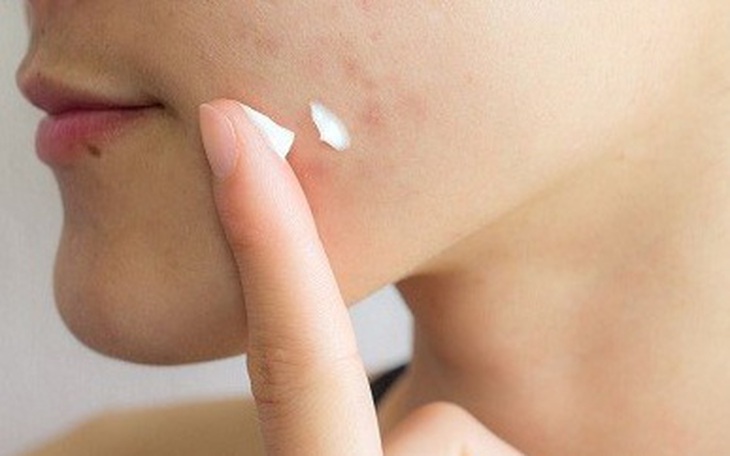 Thu hồi toàn quốc 2 lô gel tắm gội và sản phẩm xông tắm sau sinh - Ảnh 2.