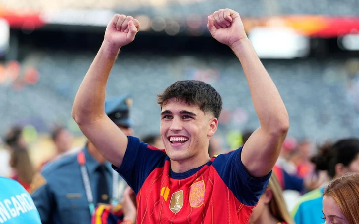 Sau World Cup 2026, Vinicius gây xôn xao với diện mạo khác lạ do... phẫu thuật thẩm mỹ - Ảnh 3.