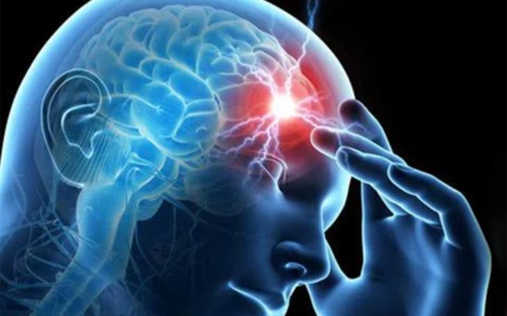 Phối hợp xuyên biên giới cứu sống nam bệnh nhân bị đột quỵ nặng khi du lịch Thái Lan - Ảnh 2.