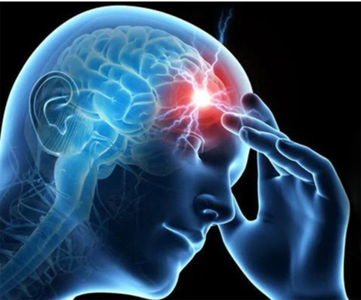 Hiểu đúng về thuốc phòng ngừa và điều trị đột quỵ - Ảnh 2.