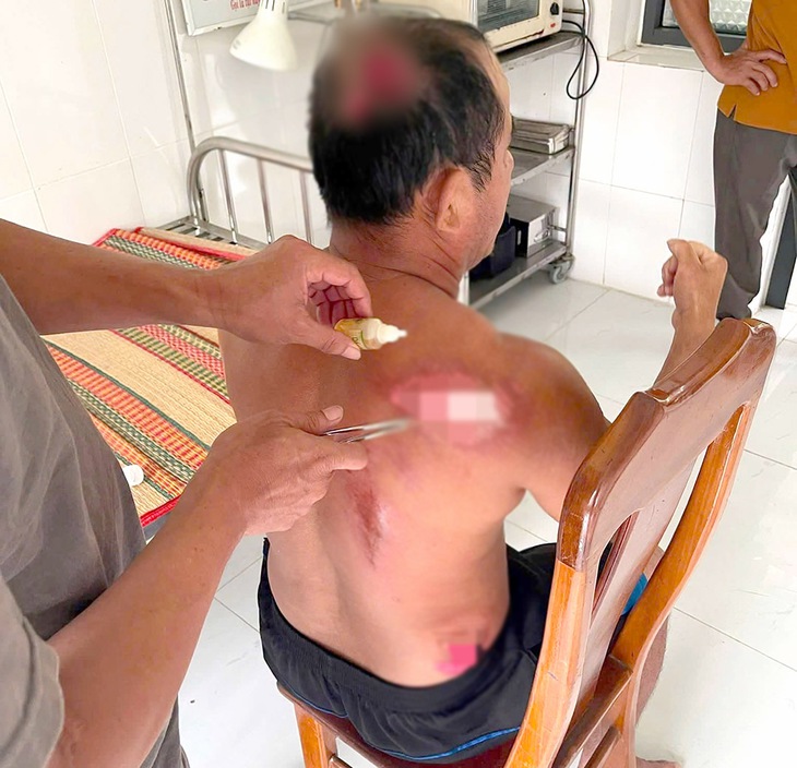 Bị tàu khác tông khiến ghe chìm, ngư dân bị thương bơi 1 hải lý - Ảnh 2.