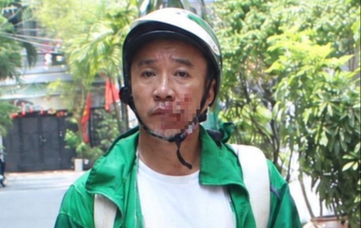 Bắt kẻ cướp giật nhiều tiền án, kéo lê nạn nhân giữa đường ở phường Đức Nhuận - Ảnh 1.