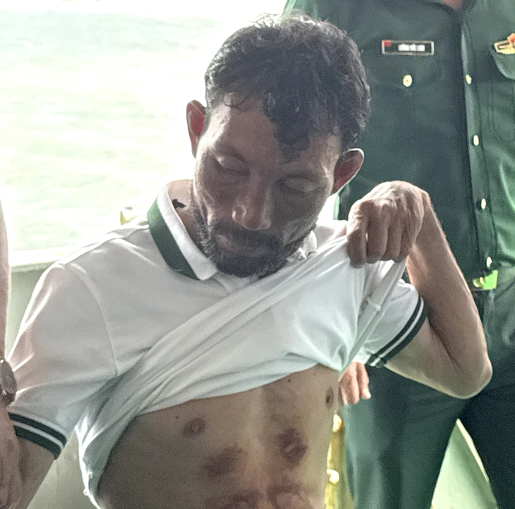 Ngư dân trôi dạt 96 giờ trên biển đã 'chạm' đất liền: 'Nghĩ tới hai con cần cha mà tôi ráng sống sót' - Ảnh 3.