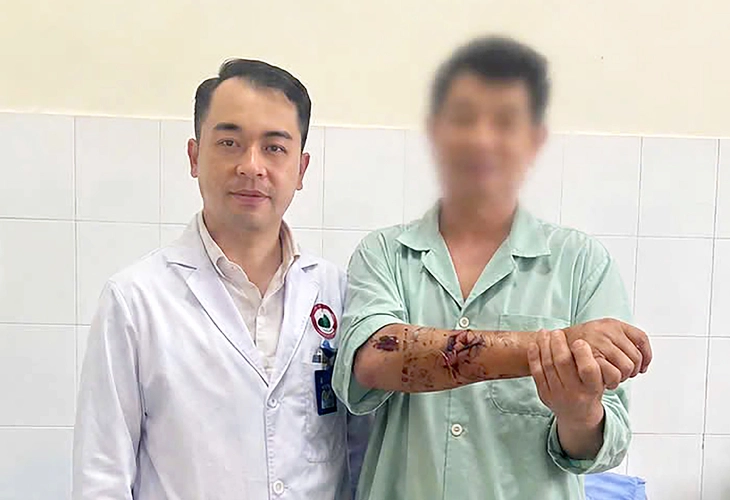 Đứt lìa tay chân, sơ cứu kiểu gì để nối lại được? - Ảnh 2.