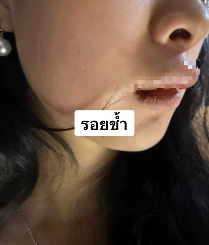 Nữ du khách Trung Quốc liều mình nhảy khỏi ô tô để thoát nhóm bắt cóc ở Thái Lan - Ảnh 6.