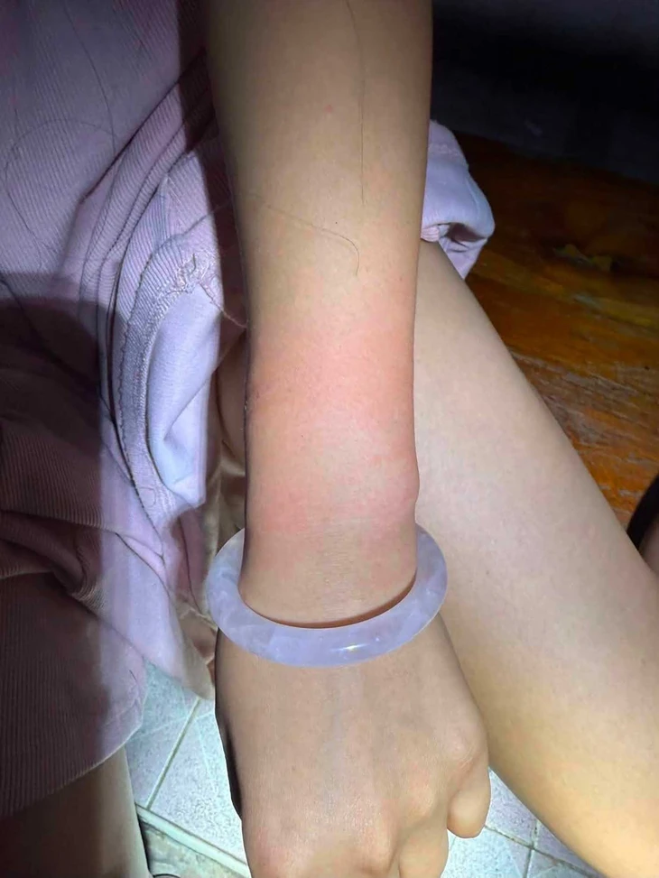Nữ du khách Trung Quốc liều mình nhảy khỏi ô tô để thoát nhóm bắt cóc ở Thái Lan - Ảnh 3.