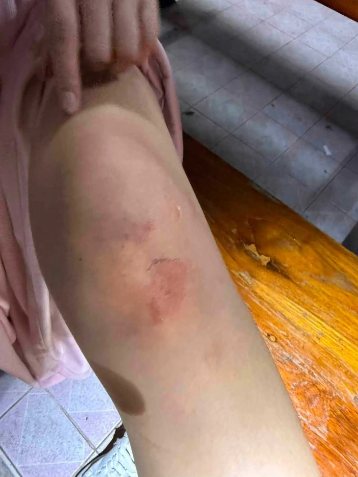 Nữ du khách Trung Quốc liều mình nhảy khỏi ô tô để thoát nhóm bắt cóc ở Thái Lan - Ảnh 4.