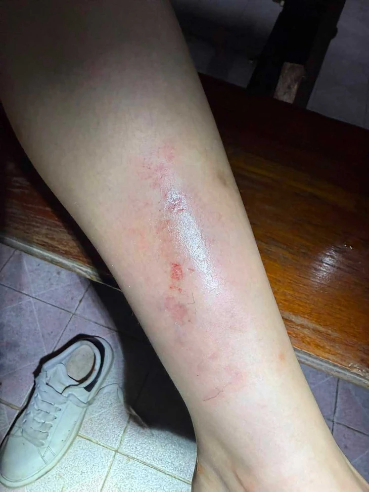 Nữ du khách Trung Quốc liều mình nhảy khỏi ô tô để thoát nhóm bắt cóc ở Thái Lan - Ảnh 5.