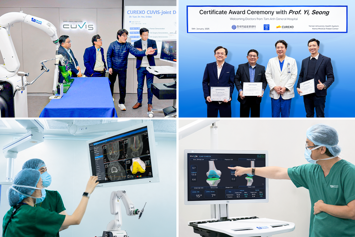 ‘Robot AI thay khớp’ của Bệnh viện Tâm Anh vượt mốc 100 ca khó  - Ảnh 3.