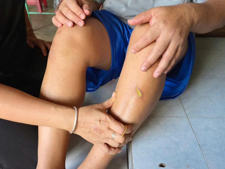 Tân sinh viên vào đại học với cảnh nhà người cha mù lòa, em trai tự kỷ - Ảnh 11.