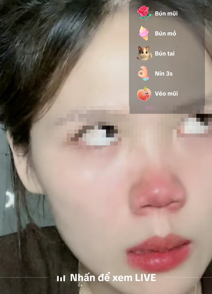 - Ảnh 2.