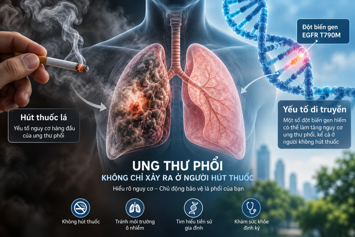 Gen hiếm làm tăng nguy cơ ung thư phổi dù không hút thuốc - Ảnh 2.