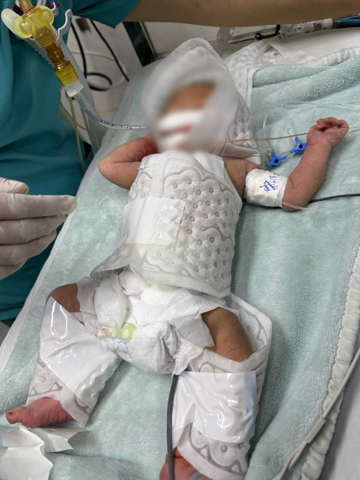 Bệnh viện Nhi đồng TP Cần Thơ lần đầu dùng kỹ thuật hạ thân nhiệt chỉ huy chữa trẻ sơ sinh bị thiếu oxy não - Ảnh 2.
