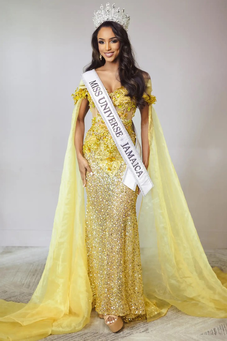 Hoa hậu Jamaica kiện Miss Universe sau cú ngã xuyên sân khấu - Ảnh 2.