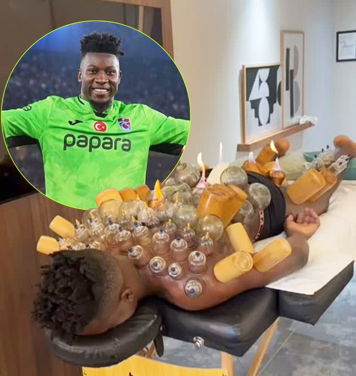 Andre Onana gây rợn người khi 'nâng tầm' liệu pháp giác hơi - Ảnh 1.