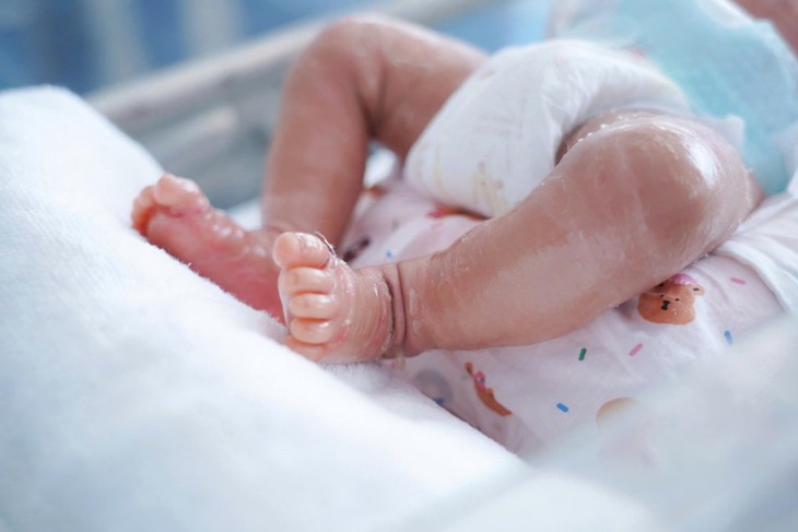 Vừa chào đời, da bé trai khô, nứt nẻ chẩn đoán bệnh lý vảy cá bẩm sinh hiếm gặp - Ảnh 1.