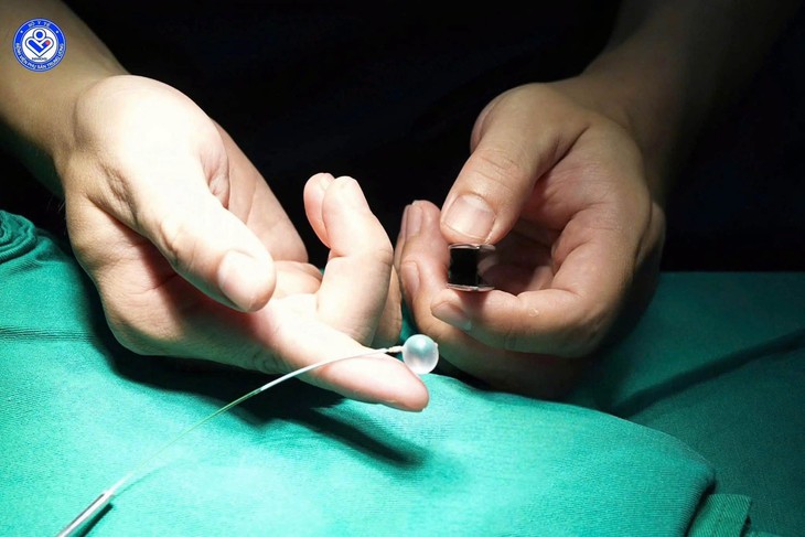 Lần đầu tiên tại Việt Nam: đặt bóng vào khí quản thai nhi 30 tuần tuổi, cứu trẻ từ trong bụng mẹ - Ảnh 1.