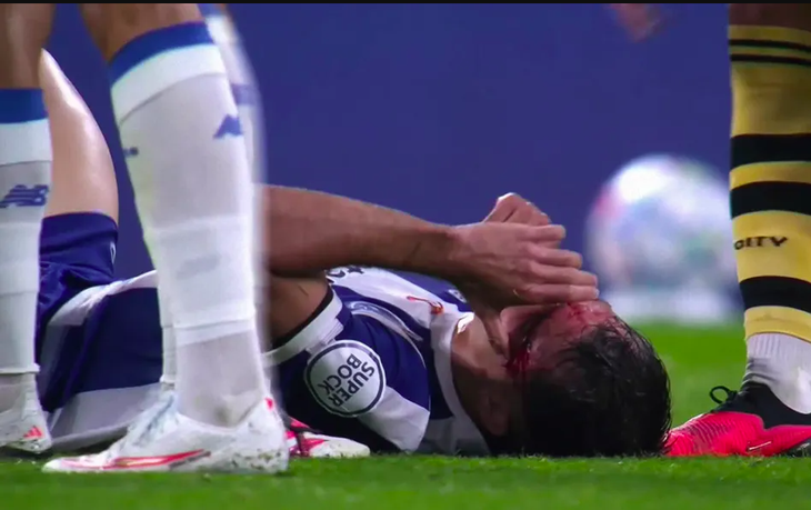 Guehi thoát thẻ đỏ, cầu thủ Man City và Porto xô xát trên đường hầm giữa hiệp - Ảnh 2.