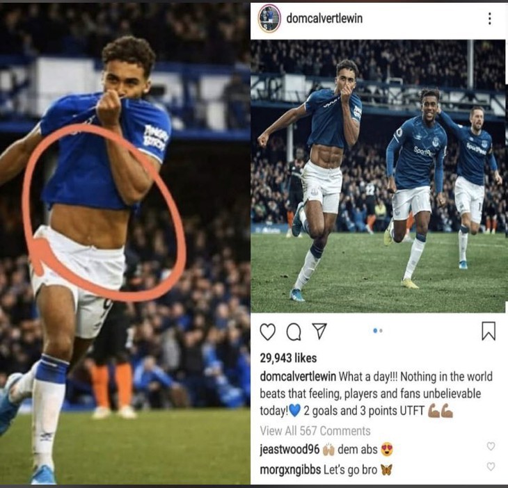 Hai bức hình khác nhau về cơ bụng 6 múi của Dominic Calvert-Lewin.