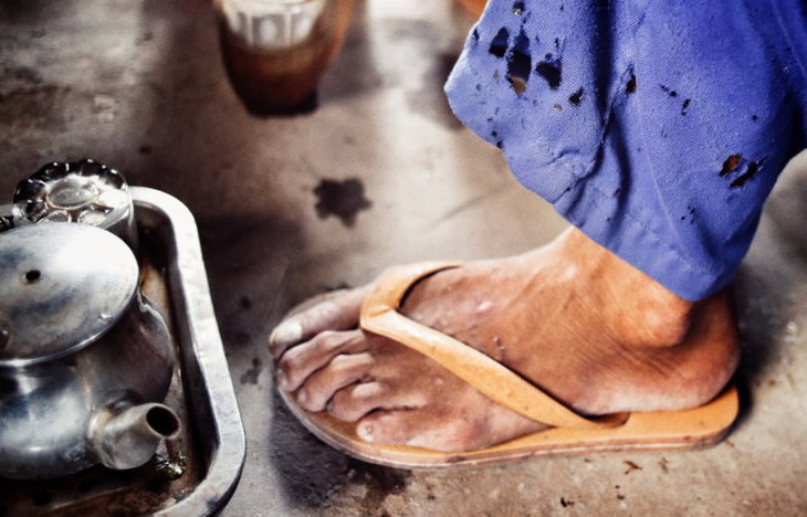 Quần áo bị thủng do bắt lửa từ lò