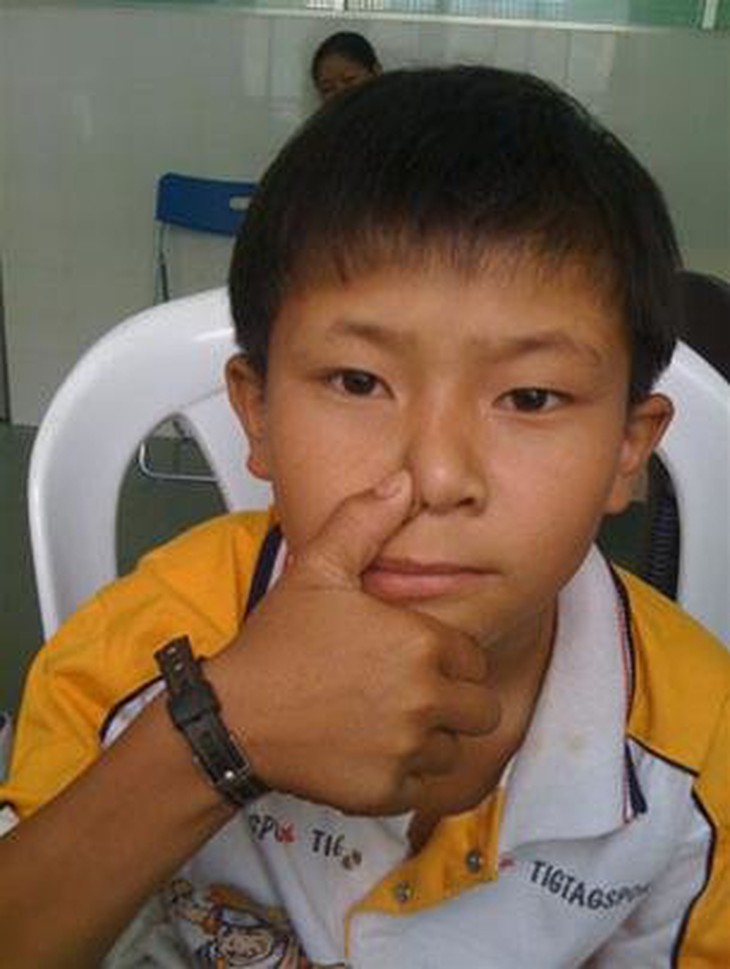 Cầm máu khi trẻ chảy máu mũi