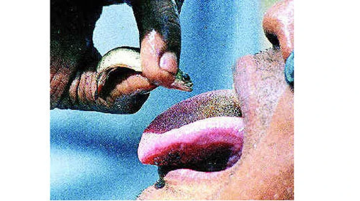 Ngậm cá rô sống , người đàn ông suýt mất mạng vì cá chui vào thực quản - Ảnh 3.