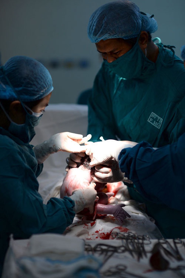 Tỉ lệ mổ lấy thai tại Việt Nam tăng nhanh, bác sĩ sản khoa nói gì?  - Ảnh 2.