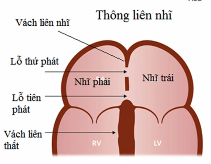  - Ảnh 2.