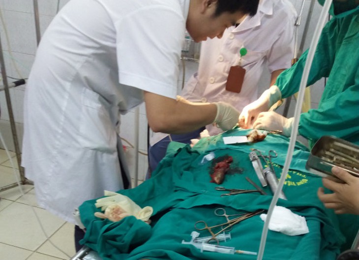 Ngậm cá rô sống , người đàn ông suýt mất mạng vì cá chui vào thực quản - Ảnh 2.
