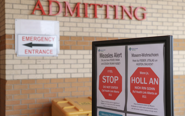 Canada loses measles elimination status after three decades
