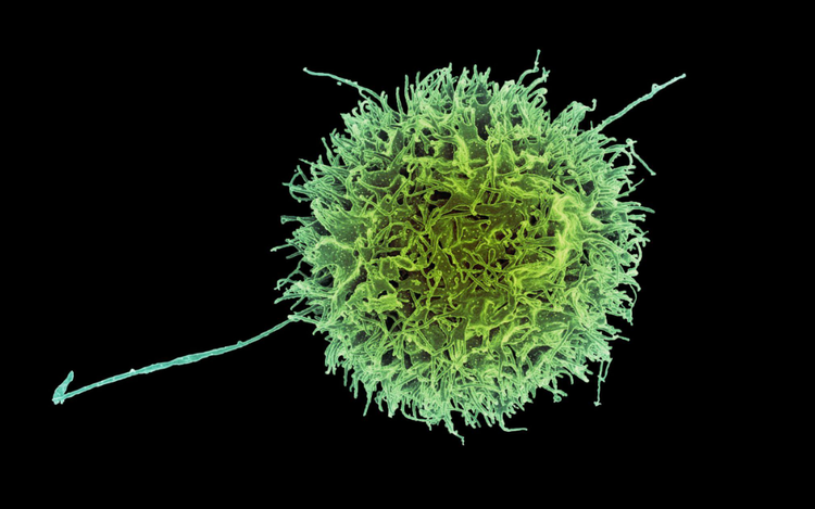 Study unlocks cancer-fighting potential of natural killer cells