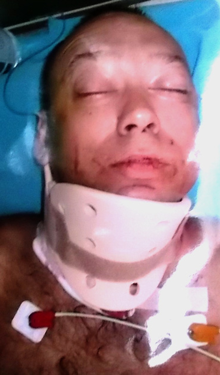 Russian stabbed by countryman in Nha Trang dies