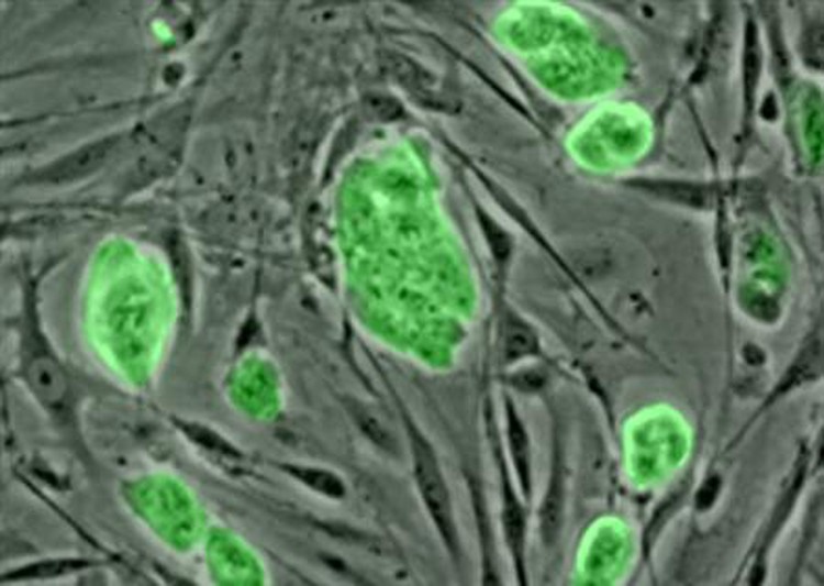 Be careful with stem cell therapy for skin